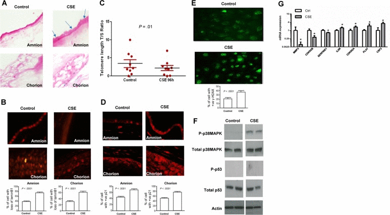 Cellular senescence in CSE-treated membranes