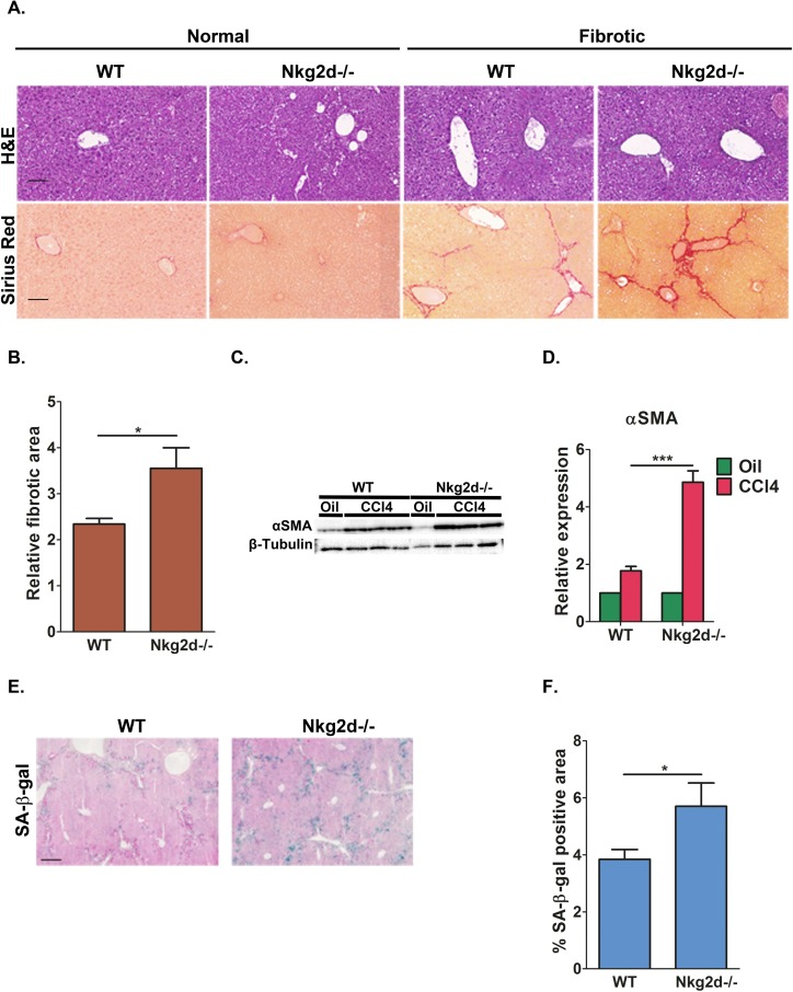 NKG2D receptor promotes senescent cell clearance and limits liver fibrosis in vivo