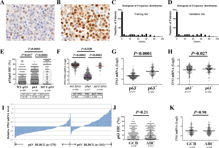 p63 expression in diffuse large B-cell lymphoma (DLBCL) in comparison with p53 expression