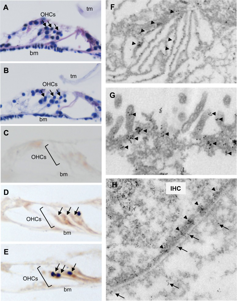 Aβ42Arc is expressed along the hair cells in the cochlea
