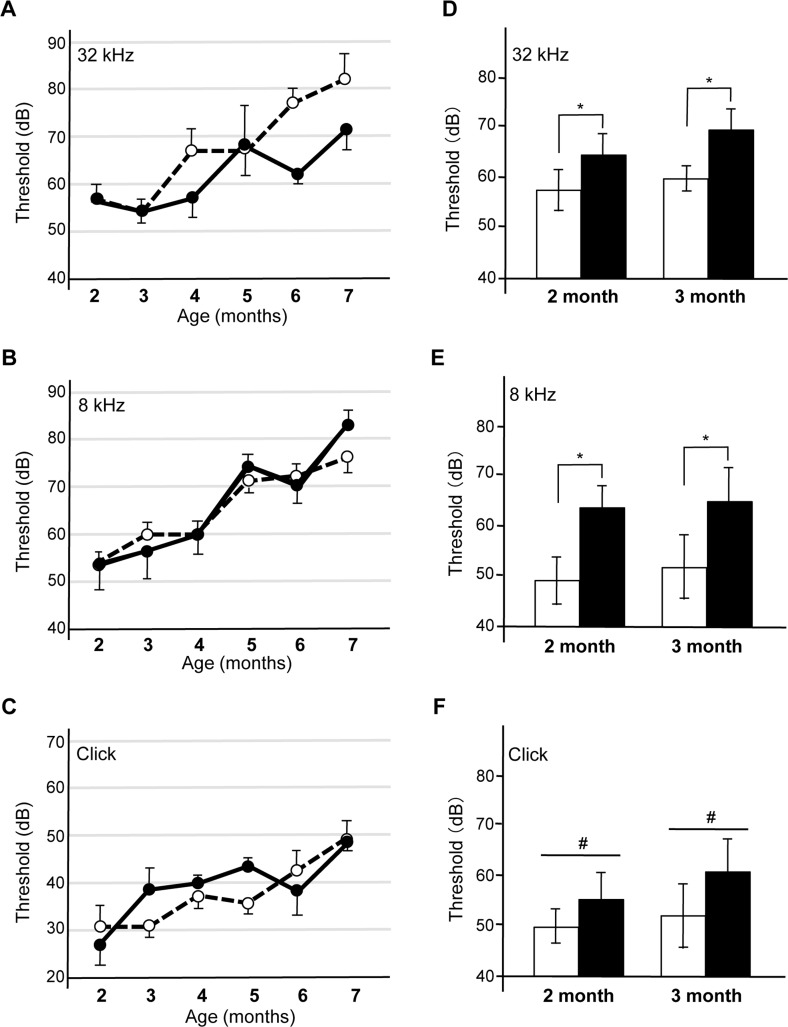The expression of human tau in the cochleae of Tg(Math1E-Aβ42Arc)1Lt mice induces a synergistic auditory deficit