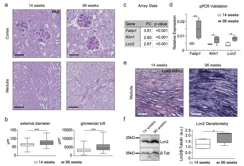 Histology, transcriptome analysis, western blot and in situ hybridization reveal a kidney aging phenotype