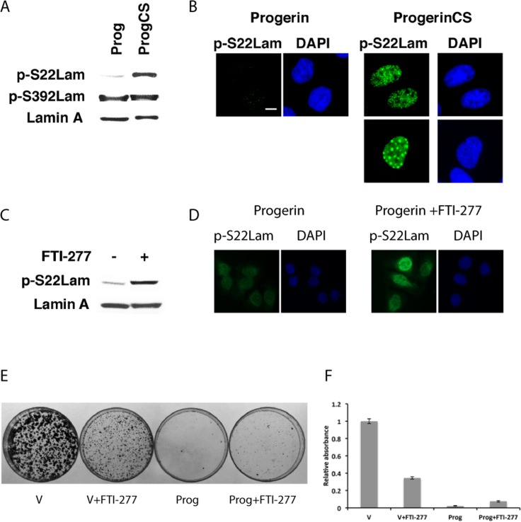 Intranuclear progerin foci contain serine 22 phosphorylated progerin