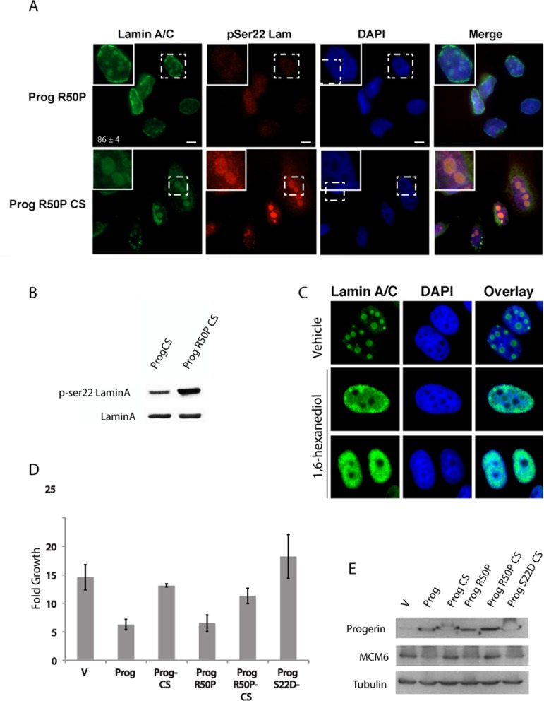 The R50P mutation increases serine 22 phosphorylation of non-farnesylated progerin