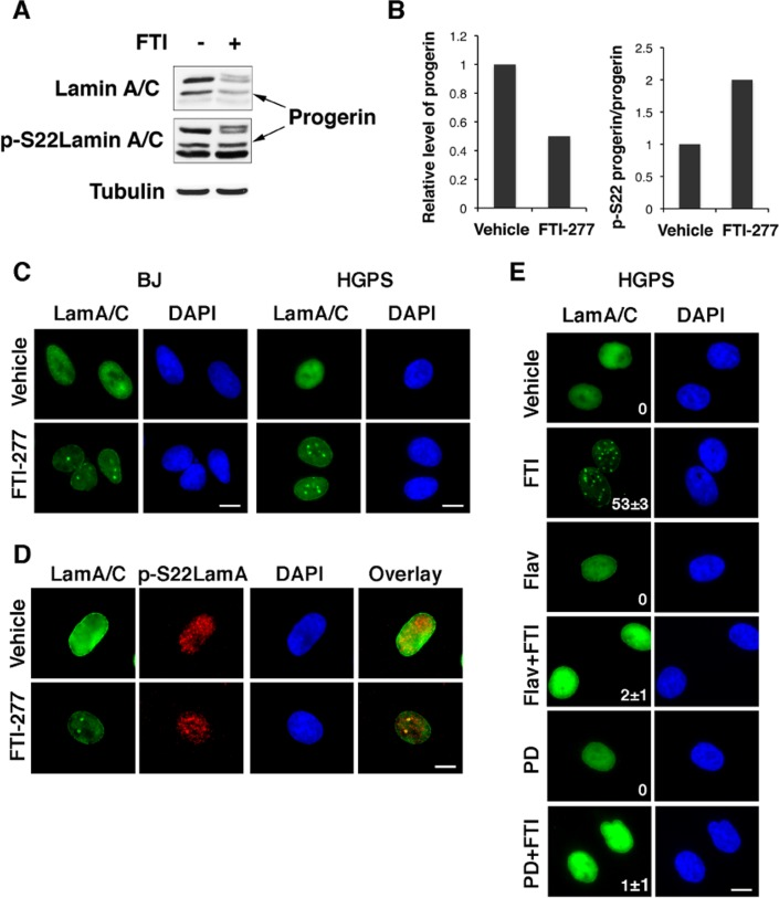 Inhibition of endogenous progerin farnesylation controls its phosphorylation and levels in fibroblasts from progeria patients