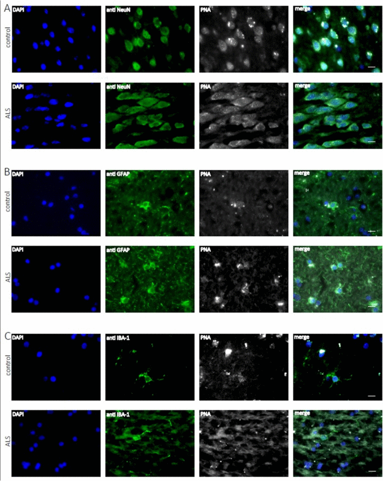 Telomere length analysis of human hippocampal ALS and control tissue at the cellular level