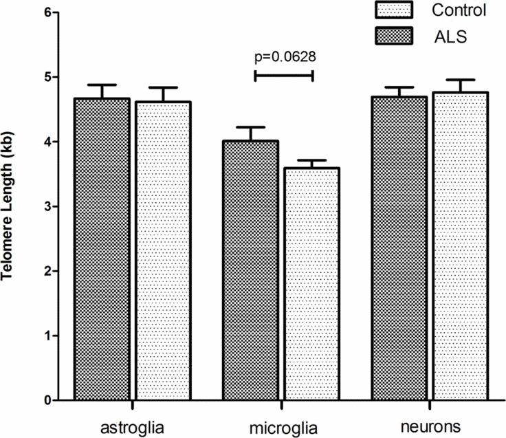 Cell type specific telomere length in hippocampal tissue of ALS- patients and non-neurological control-individuals