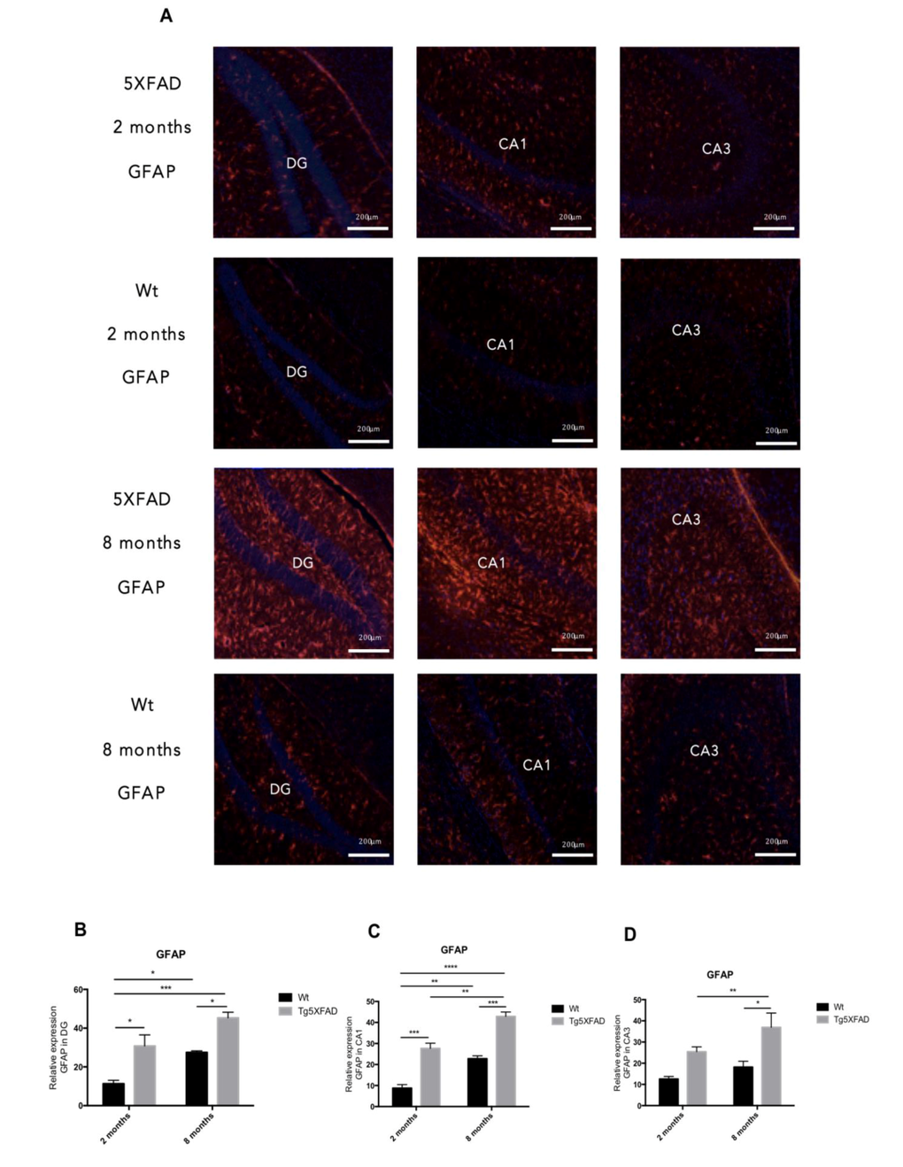 Representative images for GFAP immunostaining (A) and quantification on the bar chart (B-D) in female mice aged 2 and 8 months (Wt and 5XFAD). Bars represent mean ± Standard Error of the Mean (SEM); (n = 4 for each group). ***p