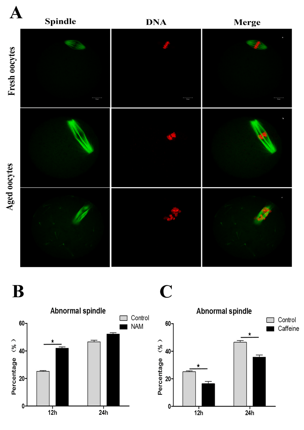 SIRT1, 2, 3 are essential for spindle morphology in aged oocytes