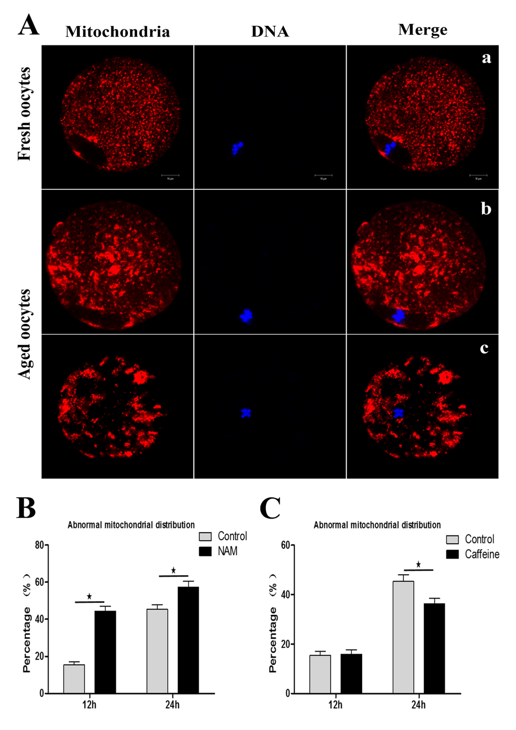 SIRT1, 2, 3 affect mitochondrial distribution during aging of MII oocytes