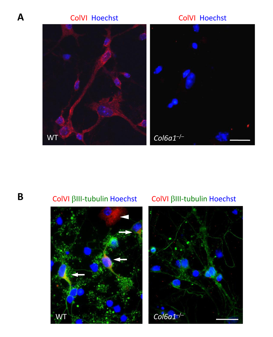 Collagen VI immunolabeling in primary neural cell cultures