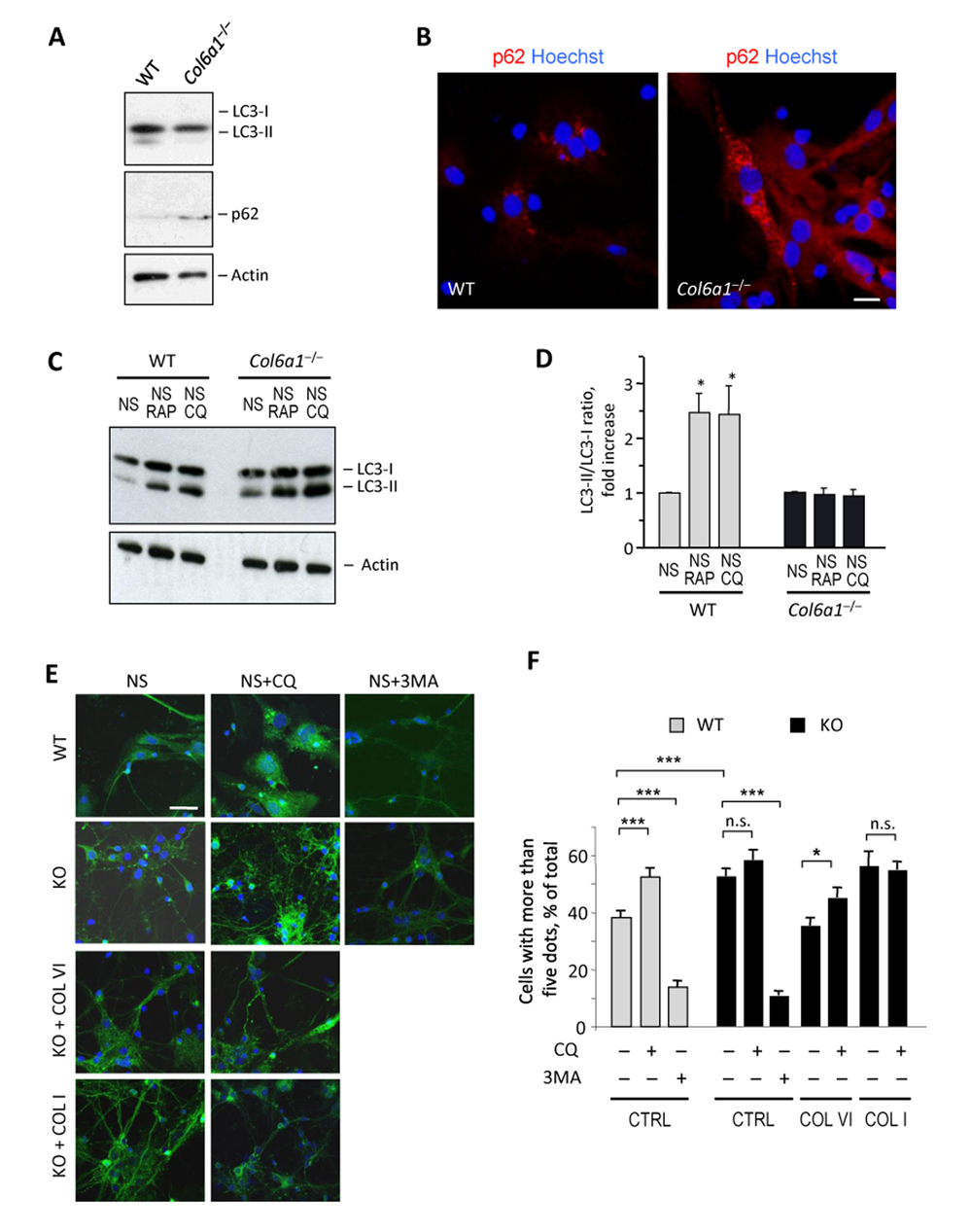 Col6a1−/− neural cell cultures display altered autophagic flux