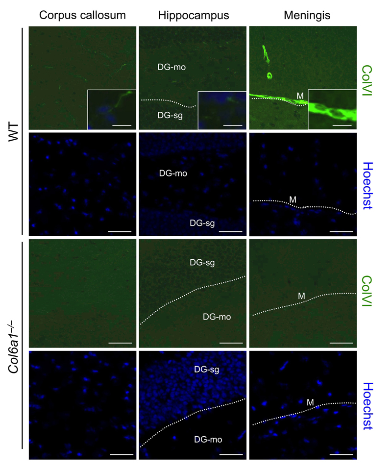 Collagen VI detection in adult mouse brain