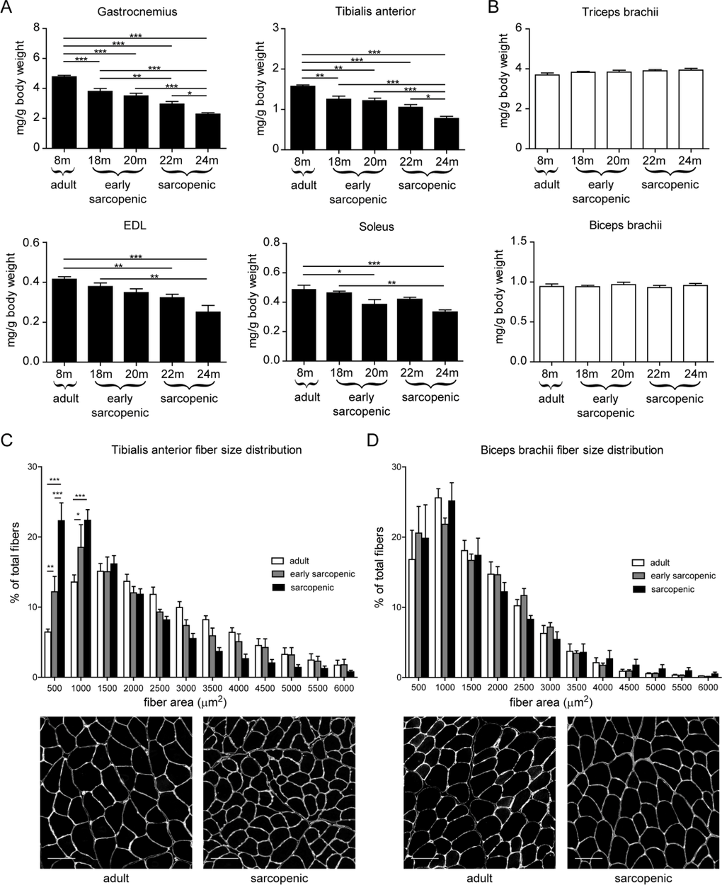 Rat forelimb muscles are resistant to age-related skeletal muscle atrophy