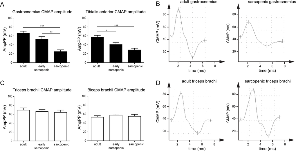 Neuromuscular transmission declines specifically with age in hindlimb but not forelimb muscles in rats