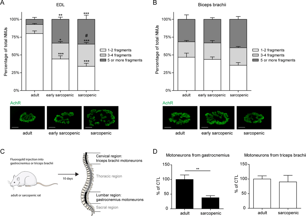 Defects in motor innervation with age are specific to hindlimb muscles