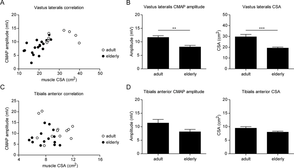 Neuromuscular dysfunction correlates with skeletal muscle atrophy in elderly men