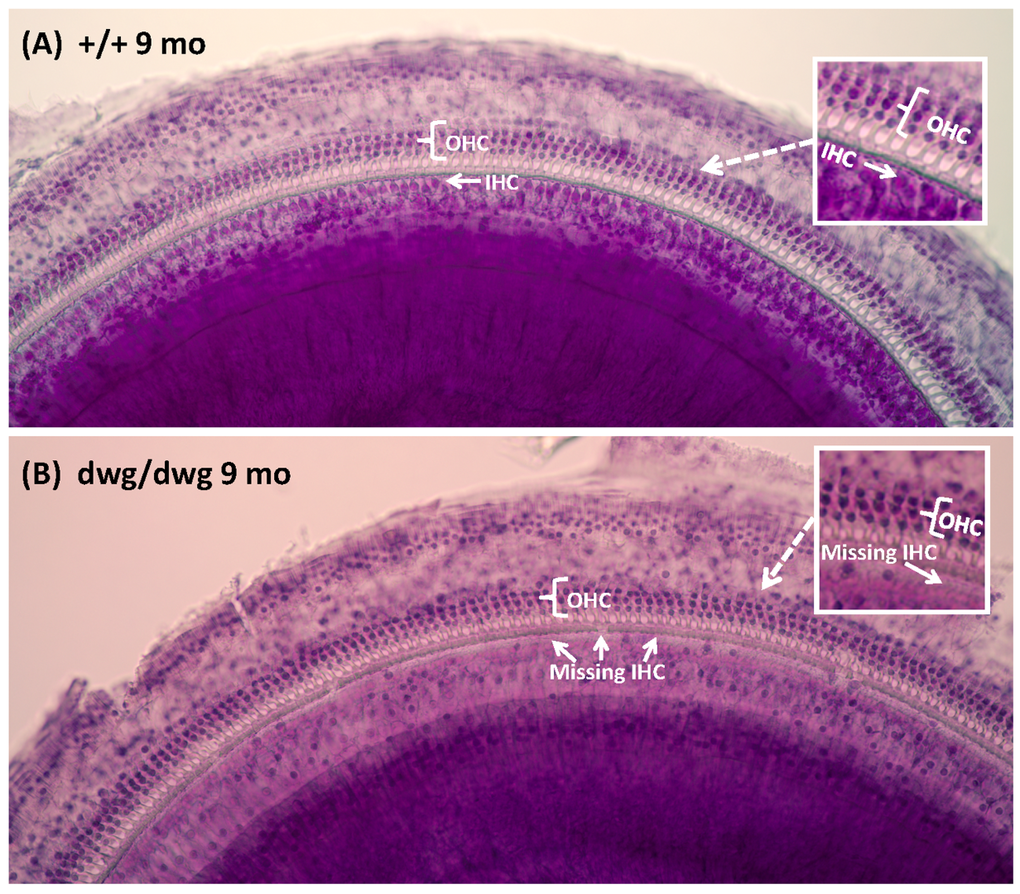 Surface preparations showing missing IHC in 9-month-old dwg/dwg mice