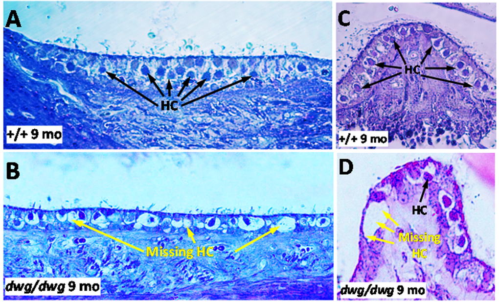 Epon embedded cross sections (3 μM) of the macula of the utricle stained with toluidine blue from a 9-month-old (A) +/+ mouse and a (B) dwg/dwg mouse. Numerous hair cells (HC) surrounded by large translucent afferent synapses decorated the vestibular hair cells in the sensory epithelium of +/+ mouse whereas many vestibular hair cells were missing and large vacuoles present in the vestibular epithelium of saccule of dwg/dwg mice. Epon embedded cross section (3 μM) of the crista of the ampulla stained with toluidine blue from a 9 month old (C) +/+ mouse and (D) dwg/dwg mouse. Numerous hair cells (HC) surround the translucent afferent synapses in the sensory epithelium in +/+ mouse whereas many HC were missing in the crista of dwg/dwg mice.