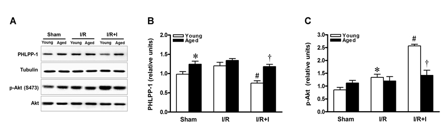 Sustained PHLPP-1 attenuated insulin-activated Akt phosphorylation