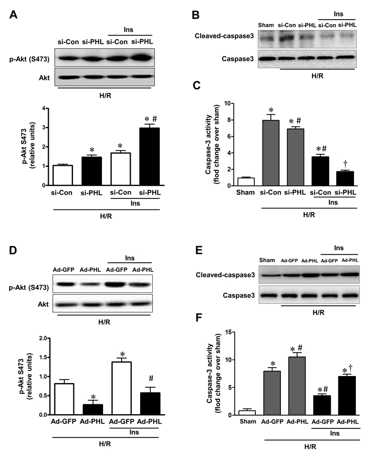 PHLPP-1 expression level affected insulin-activated Akt phosphorylation