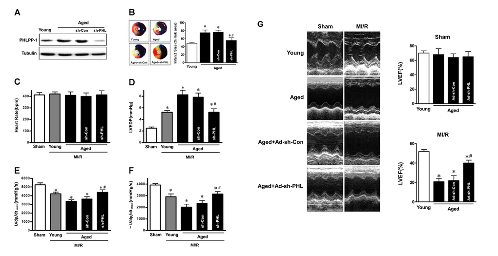 PHLPP-1 knockdown alleviated ischemic injury of aged hearts in vivo