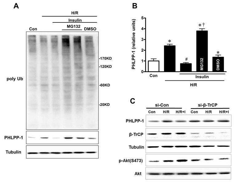 Insulin downregulated PHLPP-1 protein level through β-TrCP-mediated UPS