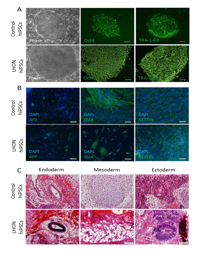 Characterization of the derived hiPSCs