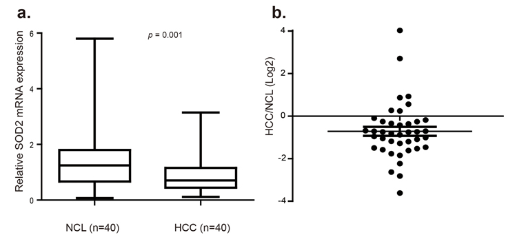 SOD2 mRNA expression is down-regulated in primary human HCC tissues