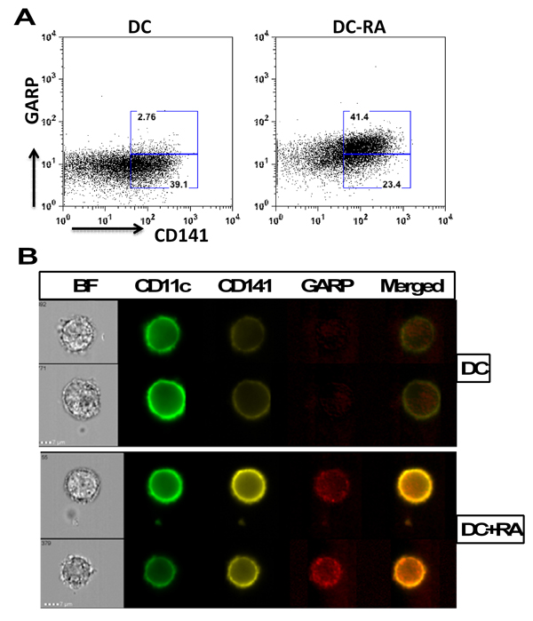 CD141 and GARP co-localize in RA treated DCs