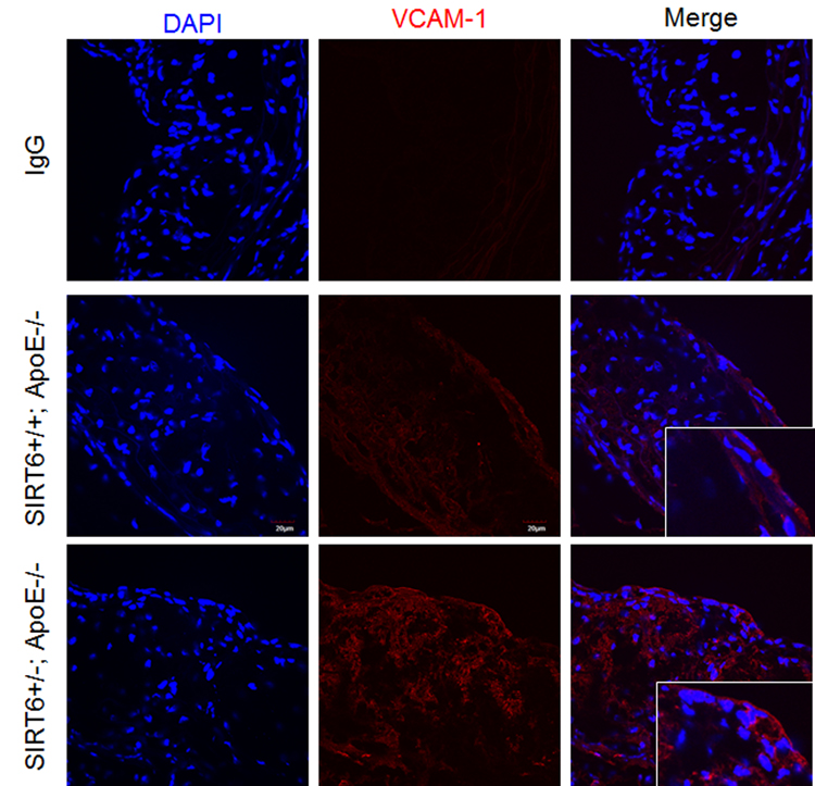 SIRT6 deficiency increases VCAM-1 expression in ApoE−/− mice