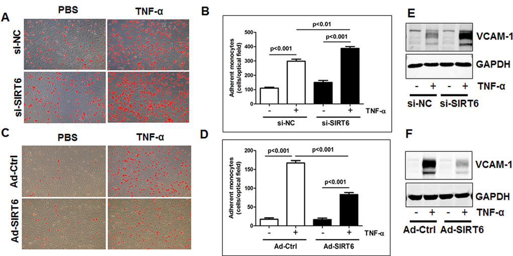 SIRT6 inhibits monocyte adhesion to endothelial cells by attenuating VCAM-1