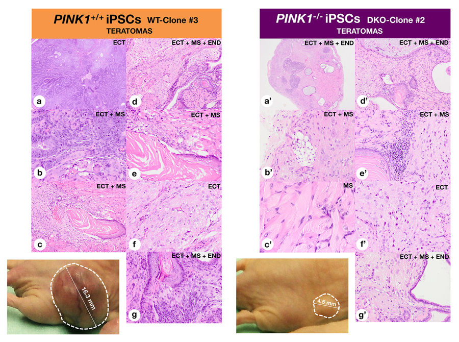 Mitophagy deficiency preserves the pluripotency of iPSCs