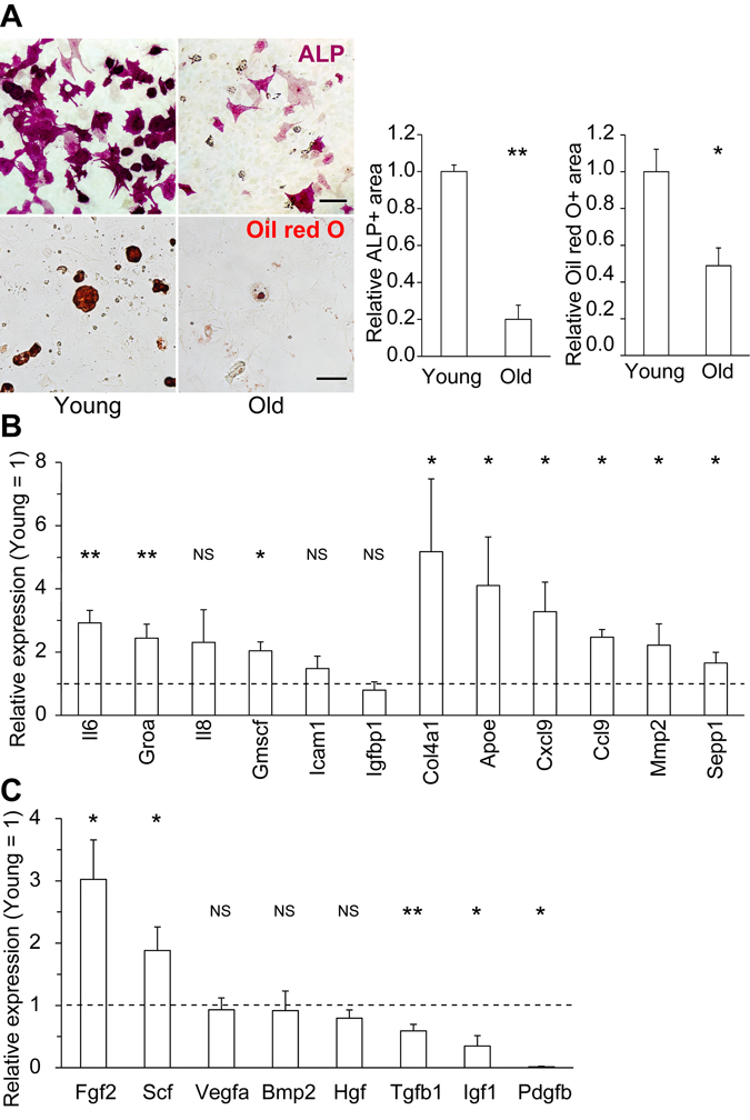 Changes in the differentiation potential and secretory profiles of old MSCs