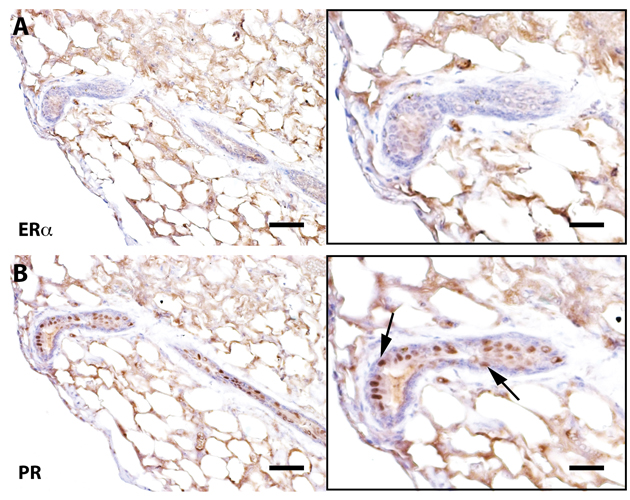 Senescent outgrowths contain PR+ cells but lack ER-α+ signaling cells