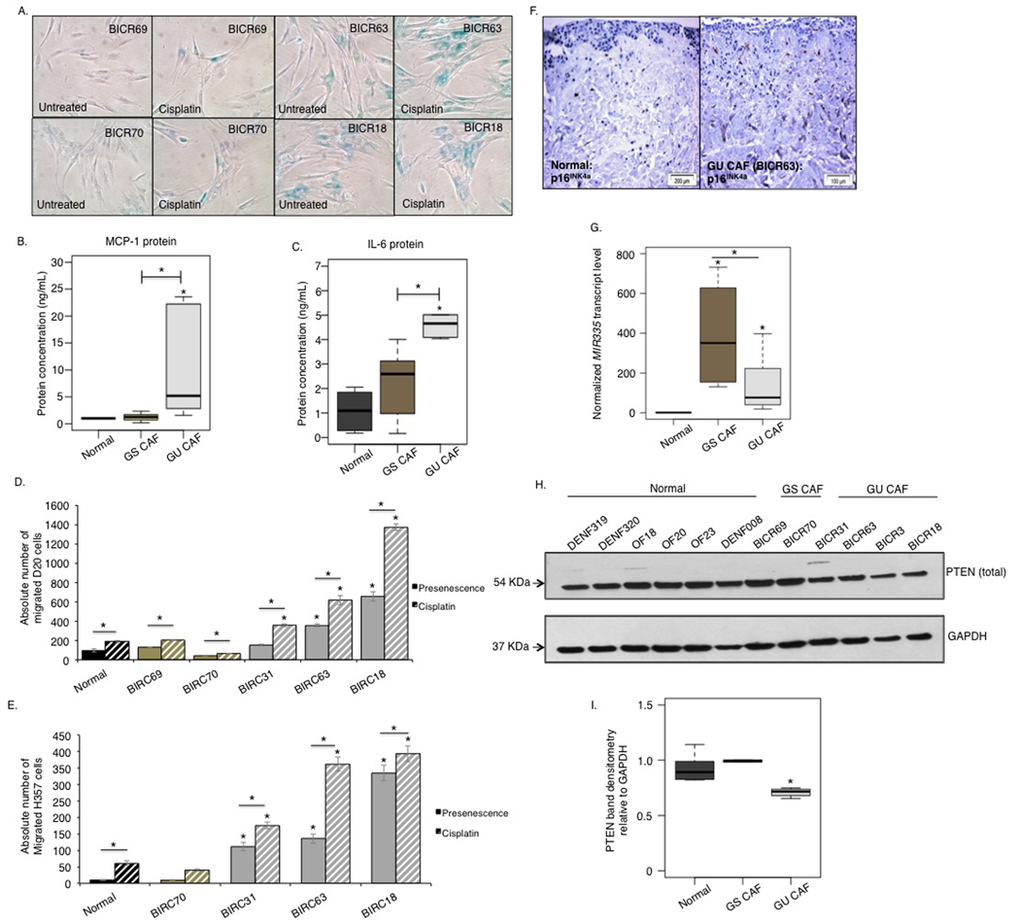 A miRNA/PTEN mediated regulatory SASP exists in senescent CAF of OSCC