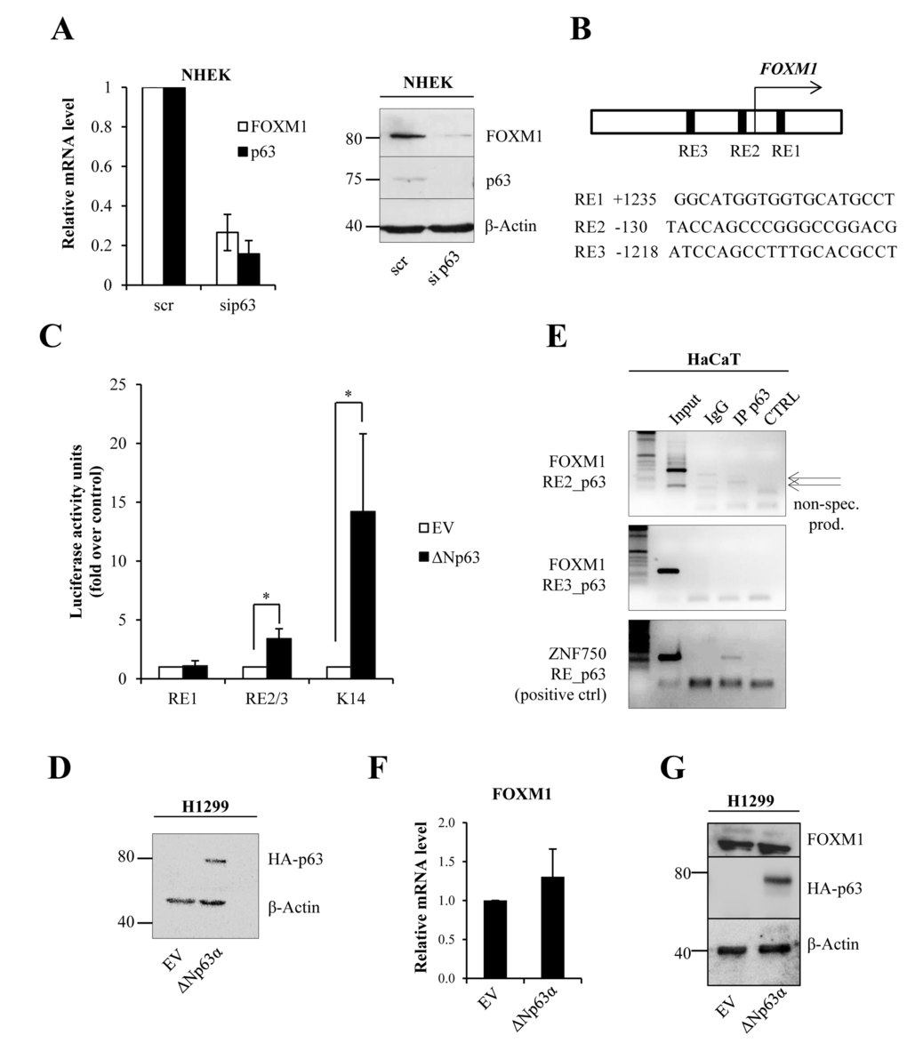 ΔNp63 indirectly regulates FOXM1 expression
