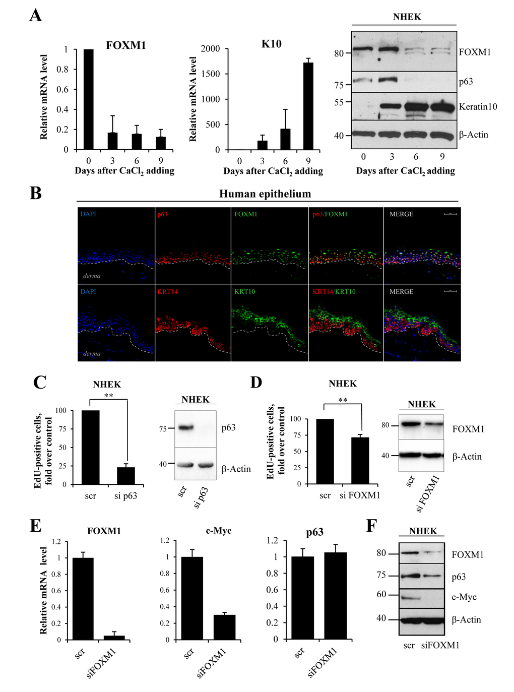 FOXM1 level correlates with proliferative status of keratinocytes