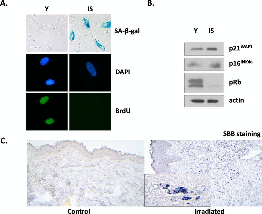 Characterization of irradiation-induced premature senescence in human breast stromal fibroblasts in vitro and in vivo