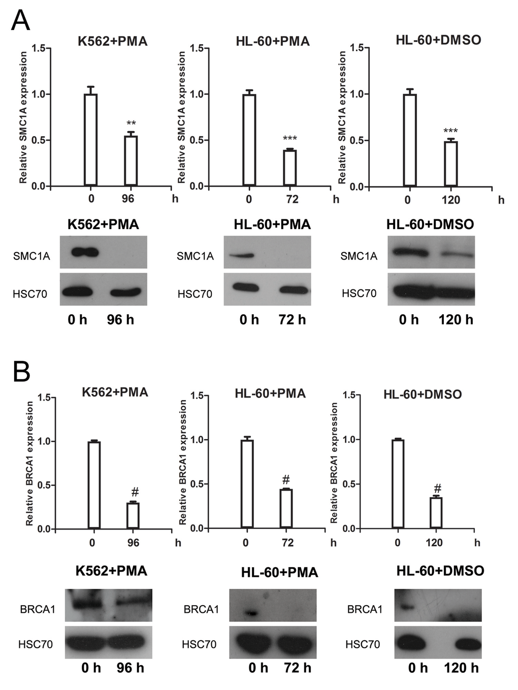 SMC1A and BRC1A expression levels are down-regulated in terminally differentiat-ed cells