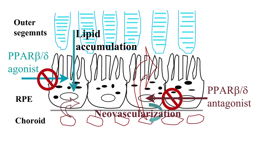 Summary model of selective regulation of dry and wet AMD related pathogenic pathways by PPARβ/δ in AMD vulnerable cells. Ligand activation of PPARβ/δ inhibits lipid accumulation by RPE cells and may have therapeutic effect in dry-AMD. In contrast, antagonism of PPARβ/δ inhibits neovascularization possibly by regulating inflammation and fibrosis in outer-retina.