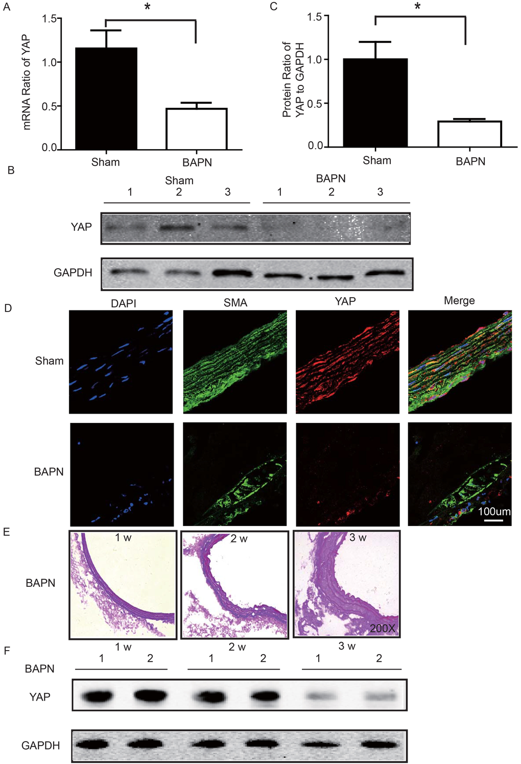 (A) Real-time PCR showing that YAP was expressed at significantly lower levels in the ascending aortic wall of the BAPN-induced STAAD mouse compared to that of the sham control (n=10 in Sham group, n=10 in BAPN group, *p=0.0337). (B, C) Western blotting showed that the total YAP protein expression was significantly lower in the ascending aortic wall of the BAPN-induced STAAD mouse compared to that of the sham control (n=10 in Sham group, n=10 in BAPN group, *p=0.0088). (D) Confocal fluorescence microscopy showing that YAP and α-SMA double stained cells were present at lower number and less expression of YAP in the ascending aortic wall of BAPN-induced STAAD mice. (E) Elastin staining of the ascending aortas of mice that were treated with BAPN for different times (1, 2 and 3 weeks) showing that the ascending aortas of mice presented significant elastin disorganization after 3 weeks of BAPN administration compared to mice receiving BAPN for 1 or 2 weeks. (F) Western blotting showing that YAP expression in the ascending aorta was lower after feeding with BAPN for 3 weeks than after feeding with BAPN for 2 weeks.