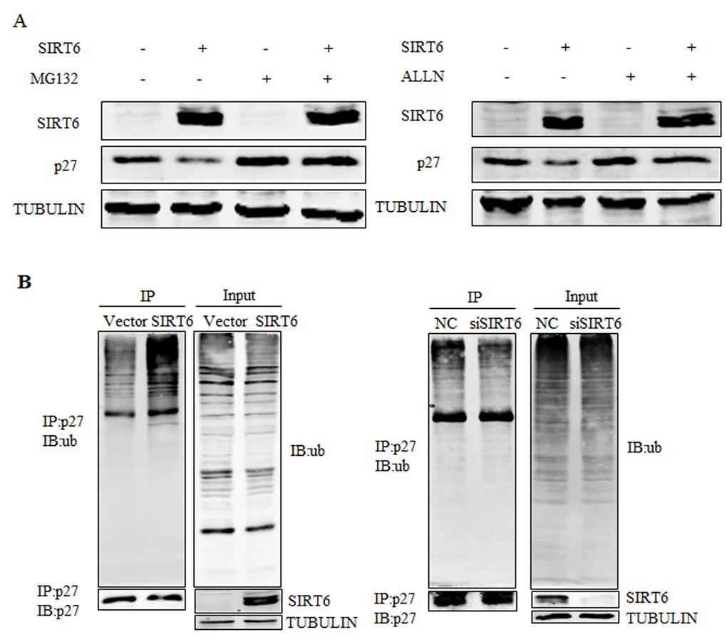 SIRT6 promotes the ubiquitination of p27. (A) 293 cells were transfected with SIRT6 and vector, twenty four hours after transfection, cells were treated with MG132 or acetyl-leu-leu-norleucinal (ALLN) 5 h before harvesting. Proteins were analyzed by western blot. (B) An in vivo ubiquitination assay was performed. 293 cells were transiently transfected with SIRT6 and vector, siRNA-SIRT6 and NC (negative control). Forty two hours later, cells were treated with MG132 for 5 h. Cells were lysed and proceeded for co-immunoprecipitation using the p27 antibody.