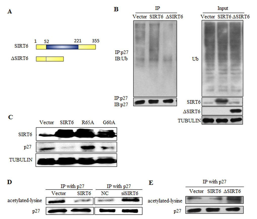 SIRT6 regulates p27 via its deacetylation activity. (A) Schematic representation of full-length SIRT6 and its central core domain deleted mutant ΔSIRT6. (B) In vivo ubiquitination assay of p27 influenced by SIRT6 deleted mutant ΔSIRT6. (C) Overexpress SIRT6 and its mutants R65A (lack deacetylase activity) and G60A (lack mono-ADP-ribosyltransferase activity) in 293 cells, then protein levels of p27 was detected. (D) In vivo acetylation assay of p27 was carried out after overexpressing and knocking down SIRT6 in 293 cells. (E) The acetylation level of p27 was detected after overexpressing wild-type SIRT6 and its deletion ΔSIRT6.