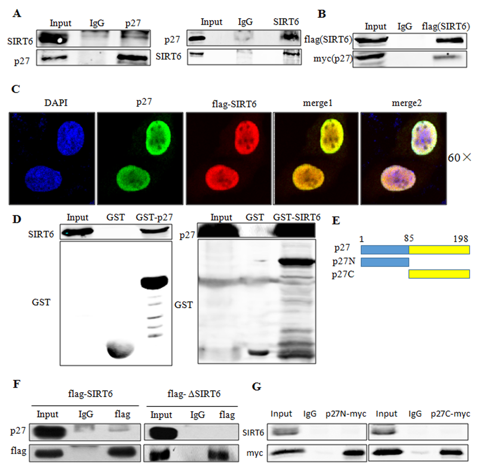 SIRT6 interacts with p27 in vivo and in vitro. (A) Co-IP of endogenous SIRT6 and p27 was performed in 293 cells. (B) Co-IP of exogenous SIRT6 (flag-SIRT6) and p27 (myc-p27) was performed using flag antibody in 293 cells. (C) 293 cells were transfected with flag-SIRT6 and p27, then immunofluorescence assay was carried out using flag and p27 antibodies to investigate the co-localization of these two proteins. (D) GST-pulldown assay using in vitro transcribed and translated SIRT6 or p27 and purified GST-p27 or GST-SIRT6 from E.coli BL21 cells. Blots were evaluated with SIRT6, p27 and GST antibodies. (E) Schematic representation of full-length p27 and its deletions. (F) 293 cells were transfected with flag-SIRT6 and flag-ΔSIRT6. Cell lysates were then used for co-IP with the flag antibody. Blots were evaluated with flag and p27 antibody. (G). 293 cells were transfected with flag-SIRT6 and myc-p27N or myc-p27C, co-IP was then performed using anti-myc antibody. Blots were evaluated with myc and SIRT6 antibodies.