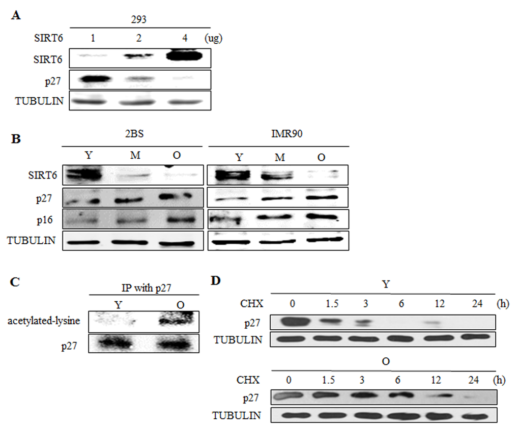 SIRT6 expression correlates with p27 acetylation level and protein half-life during cellular senescence. (A) Different amounts of SIRT6 were expressed in 293 cells. 48 h after transfection, SIRT6 and p27 were analysed by western blot. (B) Western blot analysis of SIRT6, p16 and p27 expression in young (Y, ≈PD 30), middle-aged (M, ≈PD 40) and senescent (O, ≈PD 55) 2BS and IMR90 cells. (C) The acetylation level of p27 was detected in young (Y, ≈PD 30) and senescent (O, ≈PD 55) 2BS cells. (D) The protein half-life of p27 during cellular senescence in 2BS was detected.