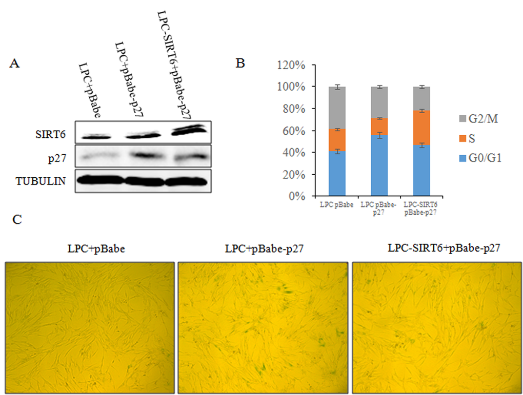 SIRT6 represses cellular senescence induced by p27. (A) 2BS cells were stably co-transfected with LPC vector and pBabe vector, LPC vector and pBabe-p27 or LPC-SIRT6 and pBabe-p27 plasmids. The expression of SIRT6 and p27 protein levels in the stable transformants were analyzed by western blot. (B) Cell cycle of cells from A was detected. Values represent the means ± S.E. of triplicate points from a representative experiments (n=3), which was repeated three times. (C) Cells from A were stained for SA-β-gal activity.
