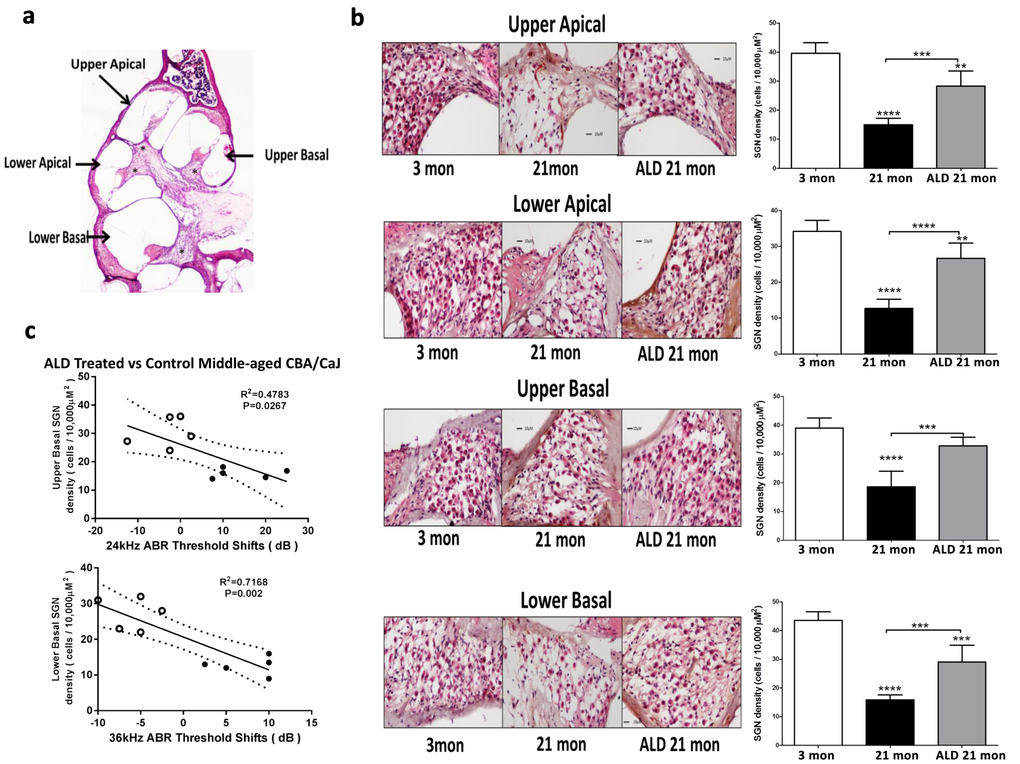 Hematoxylin/eosin (H&E) staining patterns in the cochlea reveal spiral ganglion neuron (SGN) loss with age, and rescue with aldosterone hormone treatments. (a) Cross section of the complete CBA mouse cochlea showing all turns: Section-thickness is 5 µm, Magnification: 2.5 X 1.6. All cochlear turns are distinguishable as: upper apical, upper basal, lower apical and lower basal. The cell number measurements of SGNs included all turns: (b) SGN cell count densities were measured by light microscopy for the young adult (left panel) and middle-aged mice with (right panel) and without (middle panel) aldosterone treatments; Magnification: 20 X 1.6. Right panels show bar graphs representing the SGN cell density. Mean ±SEM for each subject group. *pc) Statistically significant correlations between SGN density and 24 and 36 kHz ABR threshold shifts indicate that a reduction in the number of SGNs are associated with poorer hearing (higher ABR thresholds). Open points are for ALD treated animals, and filled points are for the controls who are undergoing normal age-related hearing loss. According to the physiological place-frequency map of the mouse cochlea (see text), 24 and 36 kHz are located at upper and lower basal turns of the cochlea, which correspond to the cochlear locations with the most cell density loss with age in CBA/CaJ mice.