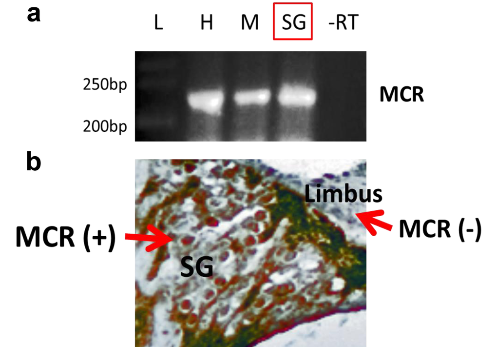 Mineralocorticoid receptor (MCR) expression and distribution in the cochlea of the young adult (3 mon) CBA/CaJ mouse. (a) Multiplex RT-PCR was performed as described in the text. This experiment includes the absence of reverse transcription (control lane -RT). The mRNA expression of MCRs in tissue from heart (H), muscle (M) and spiral ganglion neurons (SG), where the product of RT-PCR is about 245 bp. -RT- reverse transcription without primers (as the negative control). L-Ladder: DNA molecular weight markers. (b) The protein expression of MCRs in SG was detected using immunohistochemistry staining (brown color, MCR+). A portion of the limbus is shown as a cochlear region not displaying significant MCR staining (MCR-).