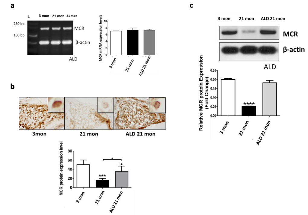 MCR presence in spiral ganglion neurons from young adult (3 mon), and aged (21 mon) control mice and those which were treated aldosterone (ALD) from 17 months up to 21 month. (a) mRNA gene expression of MCRs in young adult, aged mice and aged mice with ALD treatment were all of similar magnitudes. 3 mon: Modiolar samples from young adult mice, 21 mon: Modiolar samples from aged mice. L-Ladder: DNA molecular weight. (b) The MCR protein expression level was determined by densitometry analysis (MetaMorph Image Analysis System) of immunocytochemistry sections; upper panels show representative sections for the MCR antibody staining. The insets in the upper panels represent a typical MCR-DAB stained spiral ganglion neuron. The lower panel presents a bar graph summarizing the relative densities from densitometry measurements: Mean ± SEM for each group. (c) MCR protein expression in spiral ganglion neurons shown by western blots of modiolar tissue samples. The expression level is reported relative to the expression of beta-actin as the loading control. For both measures of protein expression (b and c), the ALD treatments helped rescue the age-related declines in MCR protein expression. Statistical significance: *p